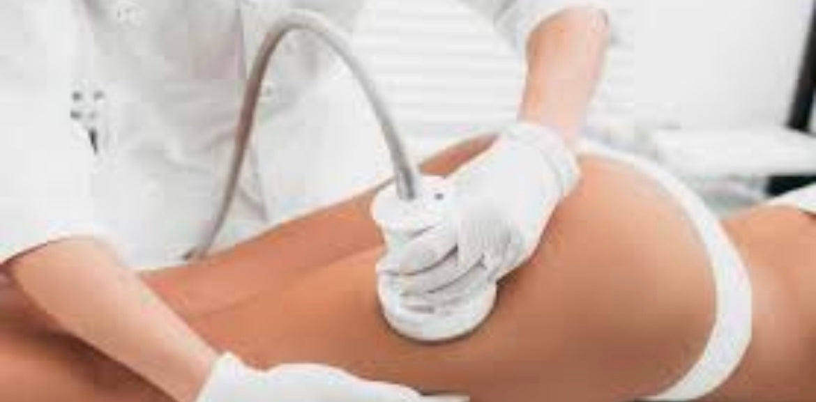 Traitement de Lipo Cavitation